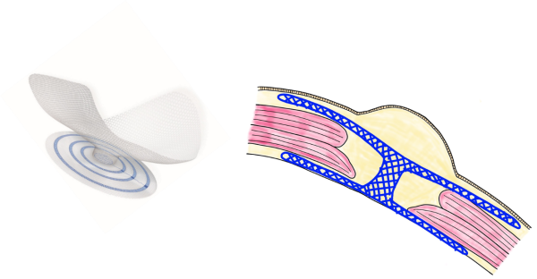 図3.ウルトラプロ®ヘルニアシステム（UHS）とメッシュ留置部